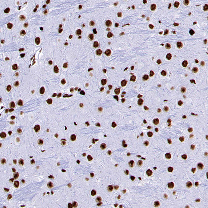 DDX39B Recombinant Rabbit mAb (S-4549-30)