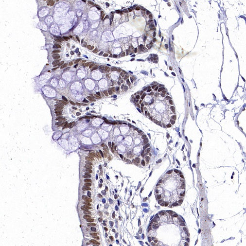 DNA Ligase IV/LIG4 Recombinant Rabbit mAb (S-2237-64)