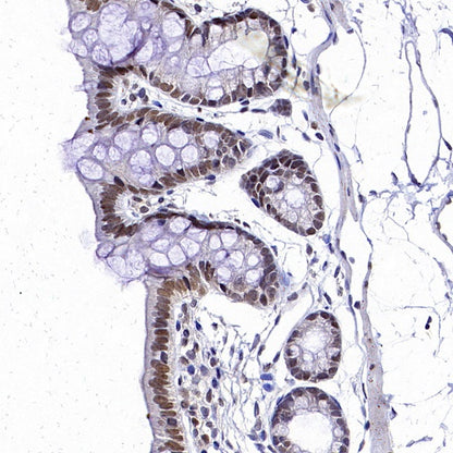DNA Ligase IV/LIG4 Recombinant Rabbit mAb (S-2237-64)