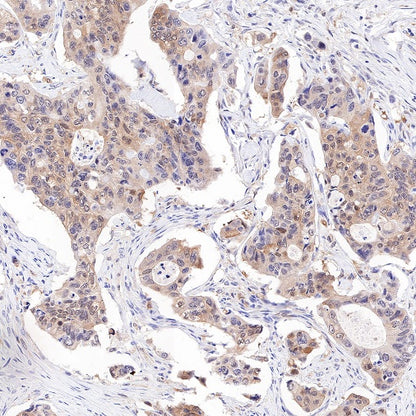 IDH1 Recombinant Rabbit mAb (S-792-16)