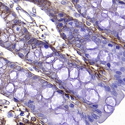 PTK7 Recombinant Rabbit mAb ,PBS Only(SDT-2432-156)