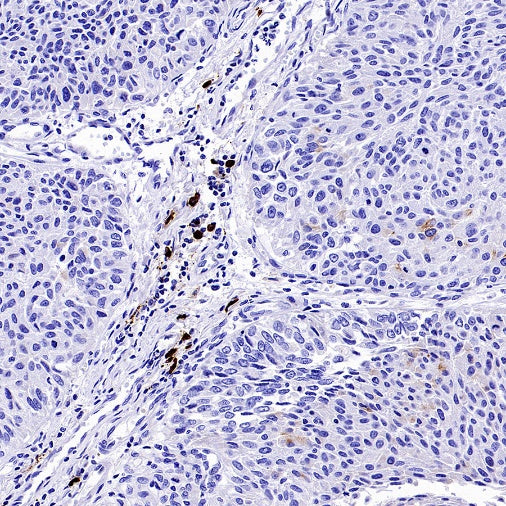 Human IgA1 Recombinant Rabbit mAb (S-2513-50)