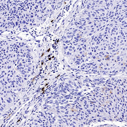 Human IgA1 Recombinant Rabbit mAb (S-2513-50)
