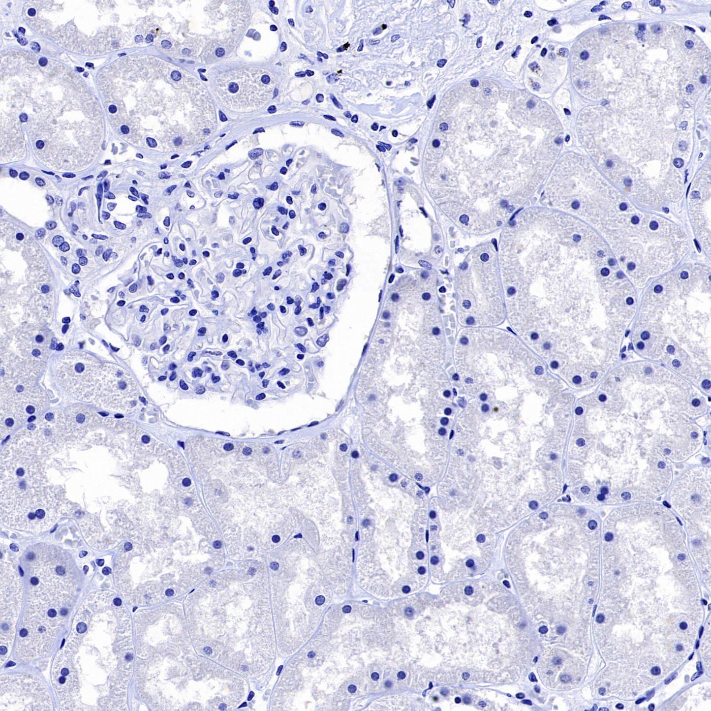 NOD2 Recombinant Rabbit mAb (SDT-3245-112)