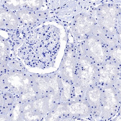 NOD2 Recombinant Rabbit mAb (SDT-3245-112)
