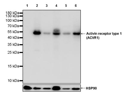 Activin receptor type 1 (ACVR1) Recombinant Rabbit mAb (S-2058-256)