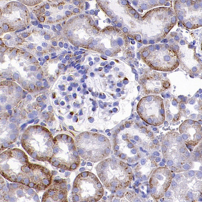 M6PR Recombinant Rabbit mAb (S-1480-21)