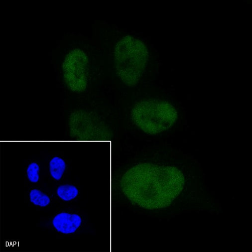 Progesterone Receptor Recombinant Rabbit mAb (Alex Fluor®488 Conjugate) (S-R123)