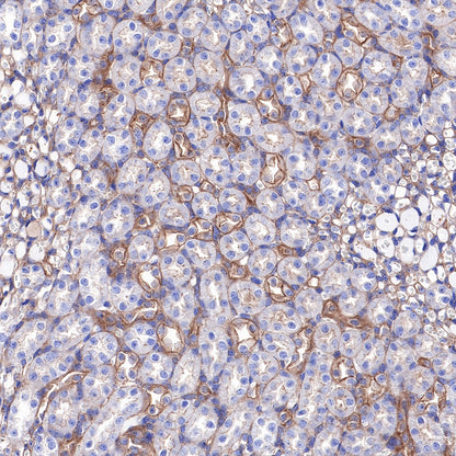 α-Actinin-1 Recombinant Rabbit mAb (SDT-311-20)