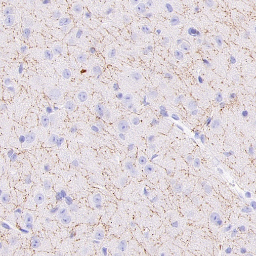5-HT (Serotonin) Transporter Recombinant Rabbit mAb (S-1332-21)