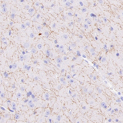 5-HT (Serotonin) Transporter Recombinant Rabbit mAb (S-1332-21)