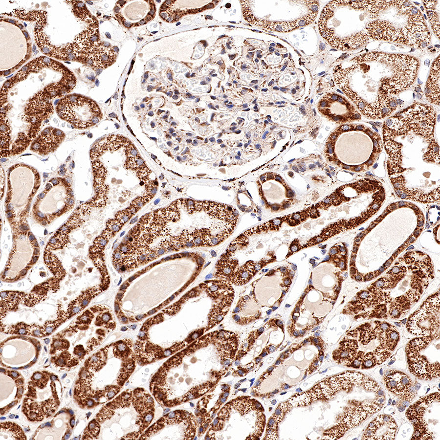 S-RMab® Stat6 Recombinant Rabbit mAb (SDT-337-32)