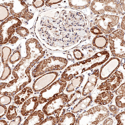 S-RMab® Stat6 Recombinant Rabbit mAb (SDT-337-32)