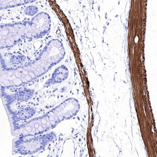 S-RMab® Desmin Recombinant Rabbit mAb (SDT-109-114)