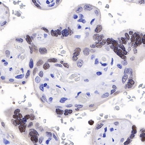 PMS2 Recombinant Rabbit mAb (SDT-111-307)