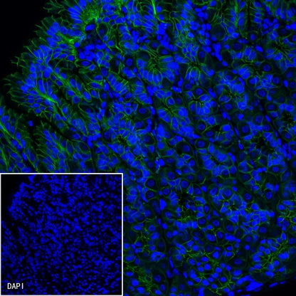E-Cadherin Recombinant Rabbit mAb (FITC Conjugate) (S-438-5)