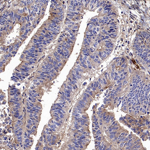 CD59 Mouse mAb (S-936-1)