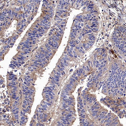 CD59 Mouse mAb (S-936-1)