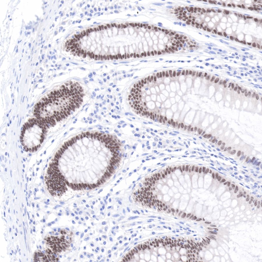 CDX2 Recombinant Rabbit mAb (SDT-134-76)