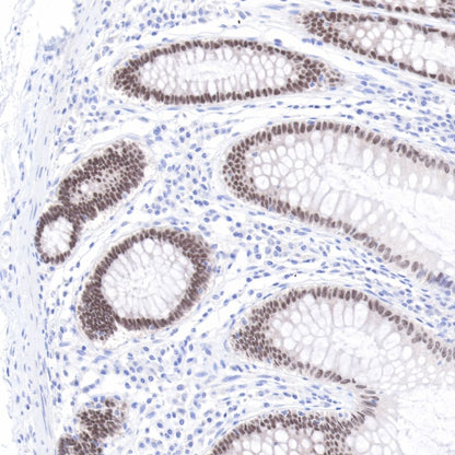 CDX2 Recombinant Rabbit mAb (SDT-134-76)