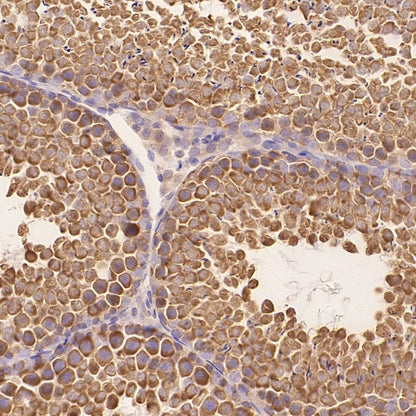 FXR1 Rabbit Polyclonal Antibody