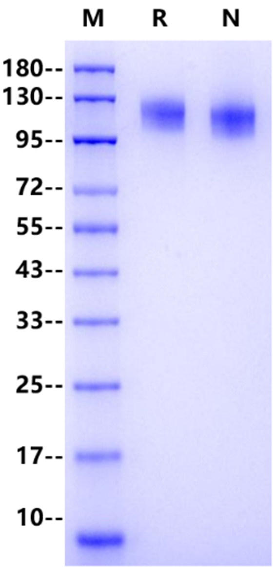 OSMR/IL-31RB His Tag Protein, Human