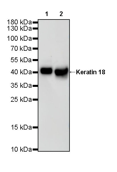 Keratin 18 Recombinant Rabbit mAb (SDT-R081)
