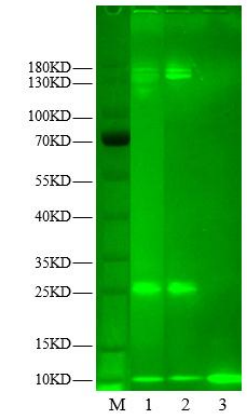DCAF16/DDB1 His Tag Protein, Human