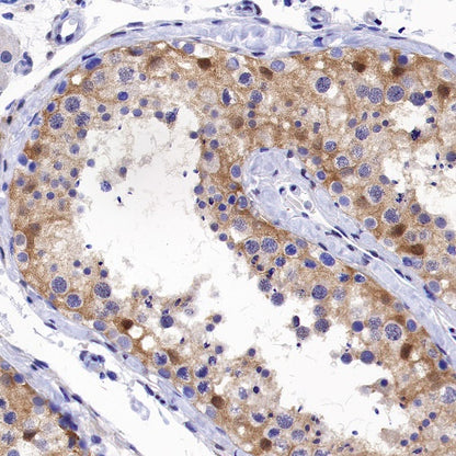 DFNA5/GSDME Recombinant Rabbit mAb (S-1703-1)
