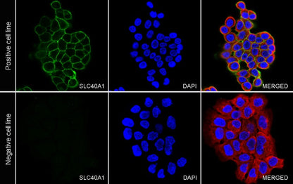 SLC40A1/Ferroportin Recombinant Rabbit mAb (S-2172-35)