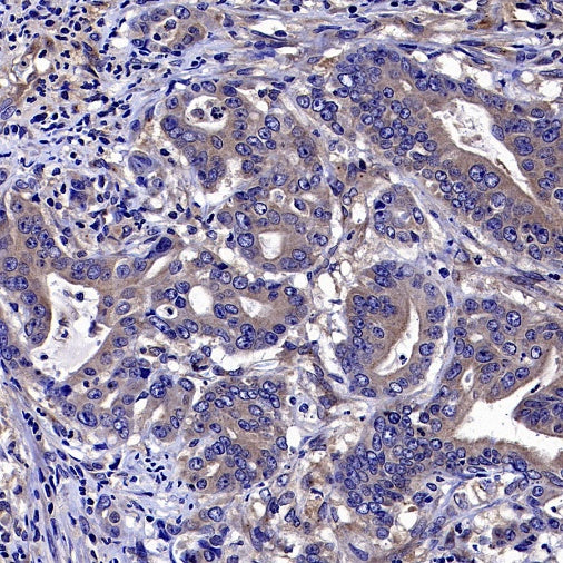 ADRB2 Recombinant Rabbit mAb (S-2418-144)