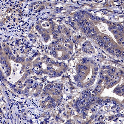 ADRB2 Recombinant Rabbit mAb (S-2418-144)
