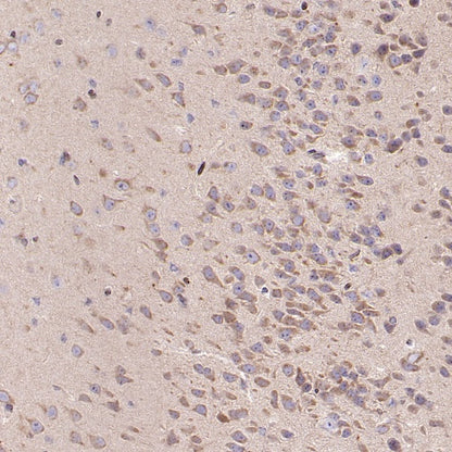 SCAMP1 Rabbit Polyclonal Antibody