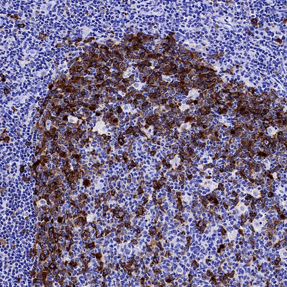 TACC3 Recombinant Rabbit mAb (S-3048-50)