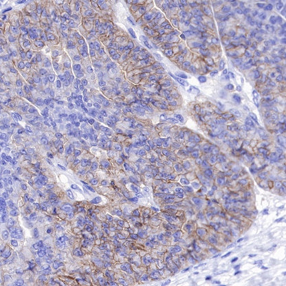 ENT1 Recombinant Rabbit mAb (SDT-R182)