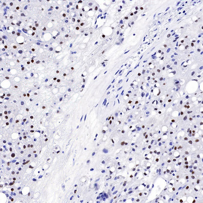 S-RMab®Steroidogenic Factor 1/SF-1 Recombinant Rabbit mAb (SDT-1666-11)