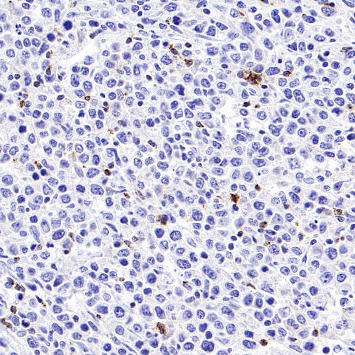 S-RMab® CD8α Mouse mAb (SDT-1036-34)