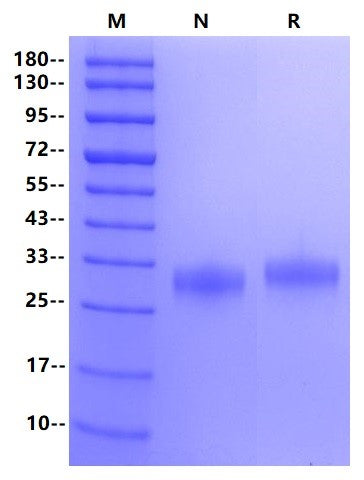 Fc γ RIIa/CD32a(H167) His tag Protein, Human