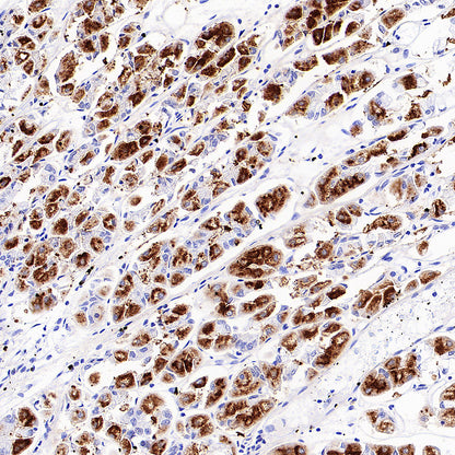 H+/K+-ATPase Recombinant Rabbit mAb (S-3474-110)