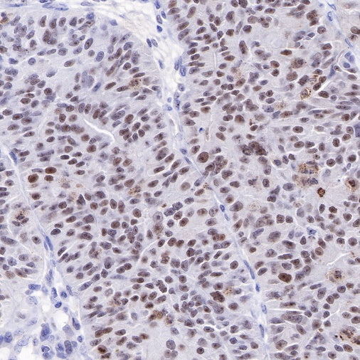 Nucleophosmin/NPM Recombinant Rabbit mAb (S-R231)