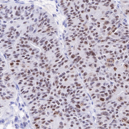 Nucleophosmin/NPM Recombinant Rabbit mAb (S-R231)