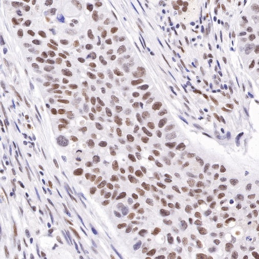 S-RMab® ATRX Recombinant Rabbit mAb (SDT-458-37)