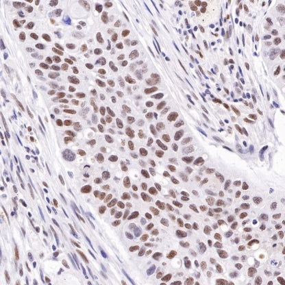 S-RMab® ATRX Recombinant Rabbit mAb (SDT-458-37)