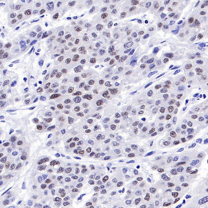 O-Linked N-Acetylglucosamine Rabbit mAb (S-R256)