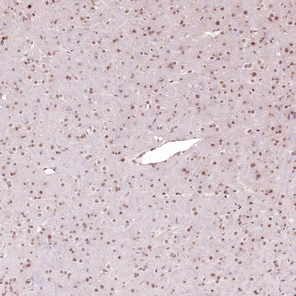 Acetyllysine Recombinant Rabbit mAb (SDT-R096)