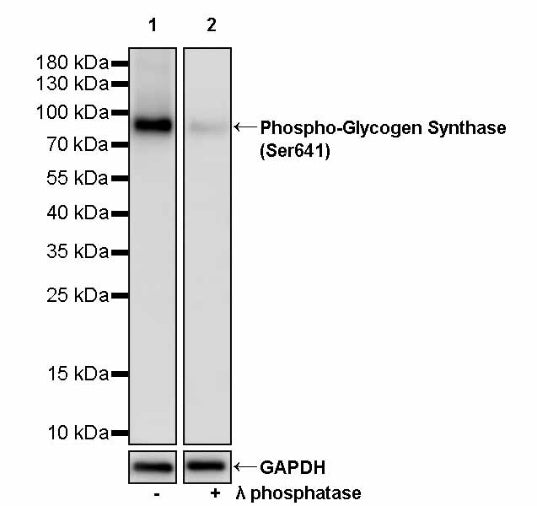 Phospho-Glycogen Synthase (Ser641) Recombinant Rabbit mAb (S-2765-18)