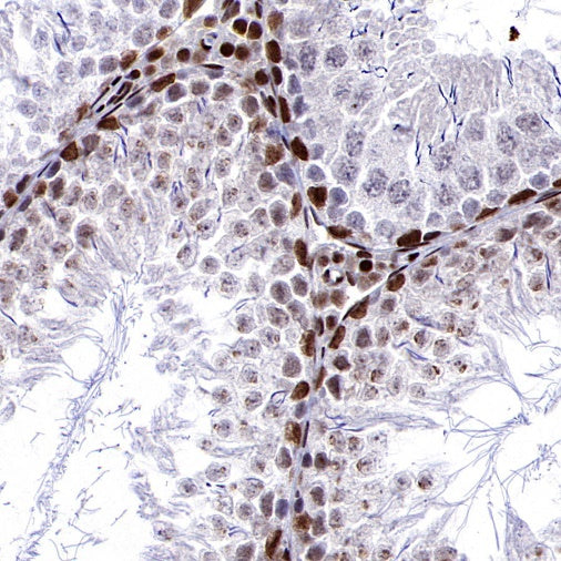 ARID1A Recombinant Rabbit mAb (S-440-62)