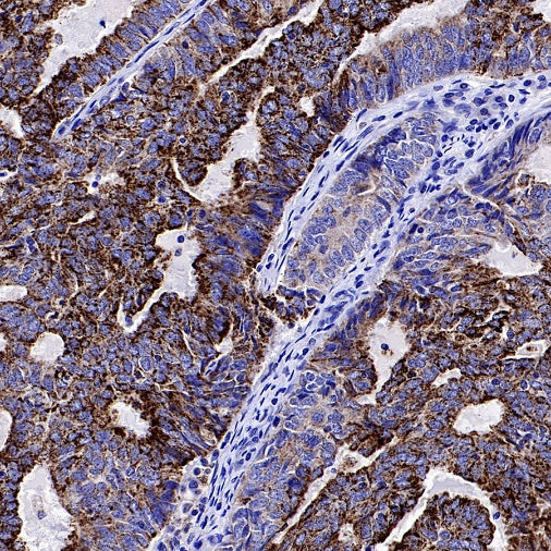 Atg13 Recombinant Rabbit mAb (S-2534-22)