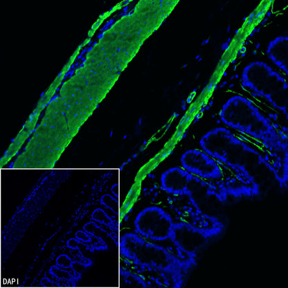 S-RMab® alpha smooth muscle Actin (SMA) Recombinant Rabbit mAb (SDT-301-142)