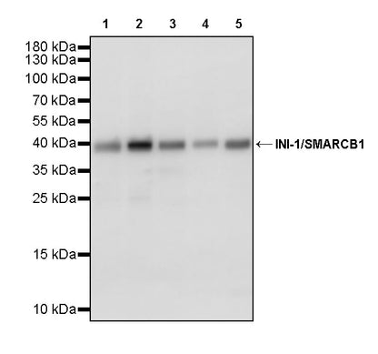 INI-1/SMARCB1 Recombinant Rabbit mAb (S-4068-21)